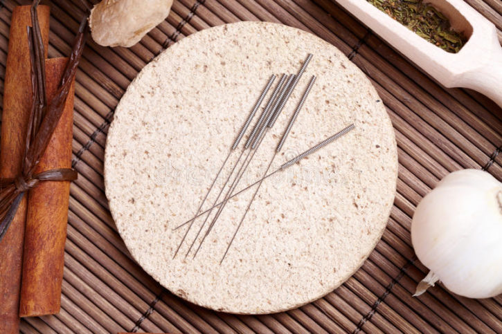 acupuncture-needles-tcm-herbs-22704372